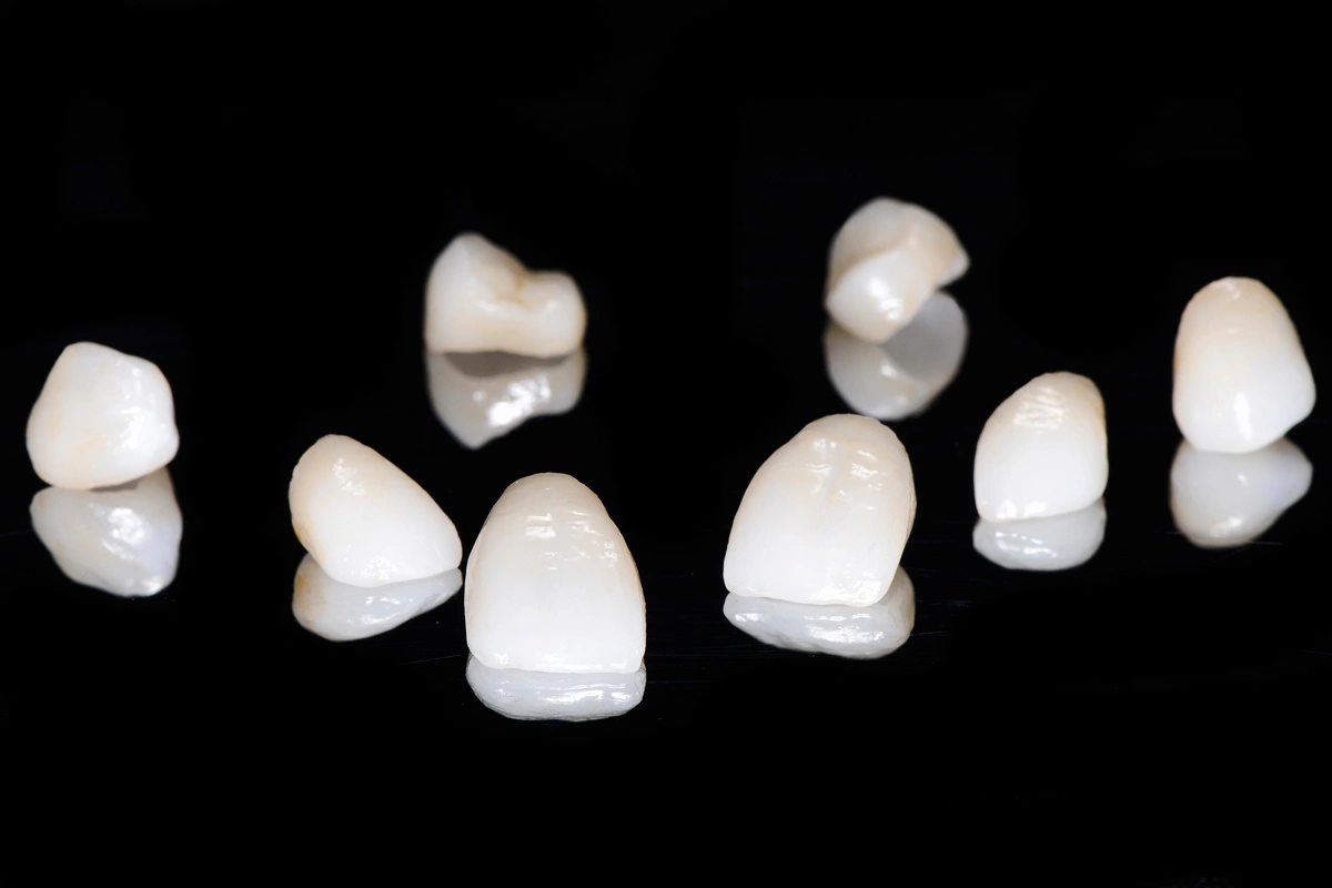 the-best-way-to-whiten-veneers-and-crowns