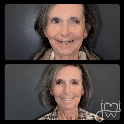 Before and after dental treatment results for a patient at Joshua M. Ignatowicz DMD & Associates