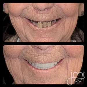 Before and after dental treatment results for a patient at Joshua M. Ignatowicz DMD & Associates