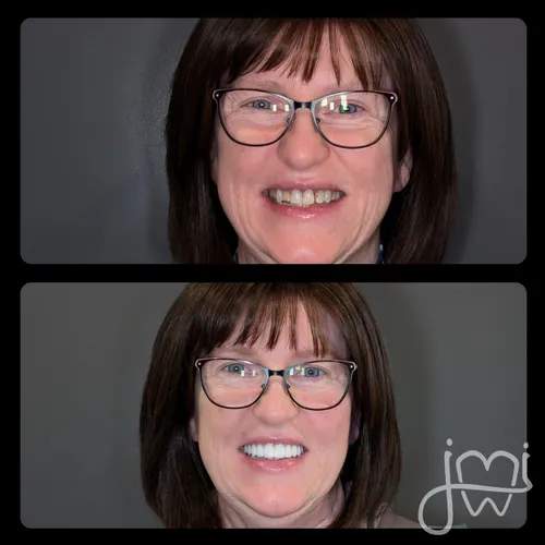 Before and after dental treatment results for a patient at Joshua M. Ignatowicz DMD & Associates