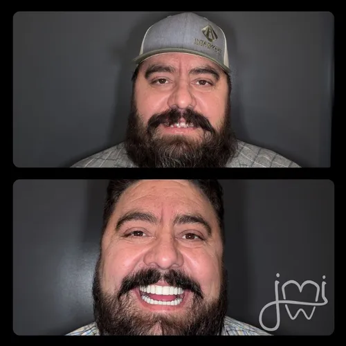 Before and after dental treatment results for a patient at Joshua M. Ignatowicz DMD & Associates