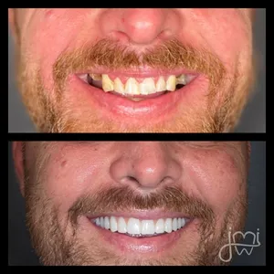 Before and after dental treatment results for a patient at Joshua M. Ignatowicz DMD & Associates