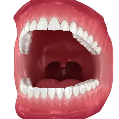 Open mouth view showing teeth and gums for Nightlase treatment