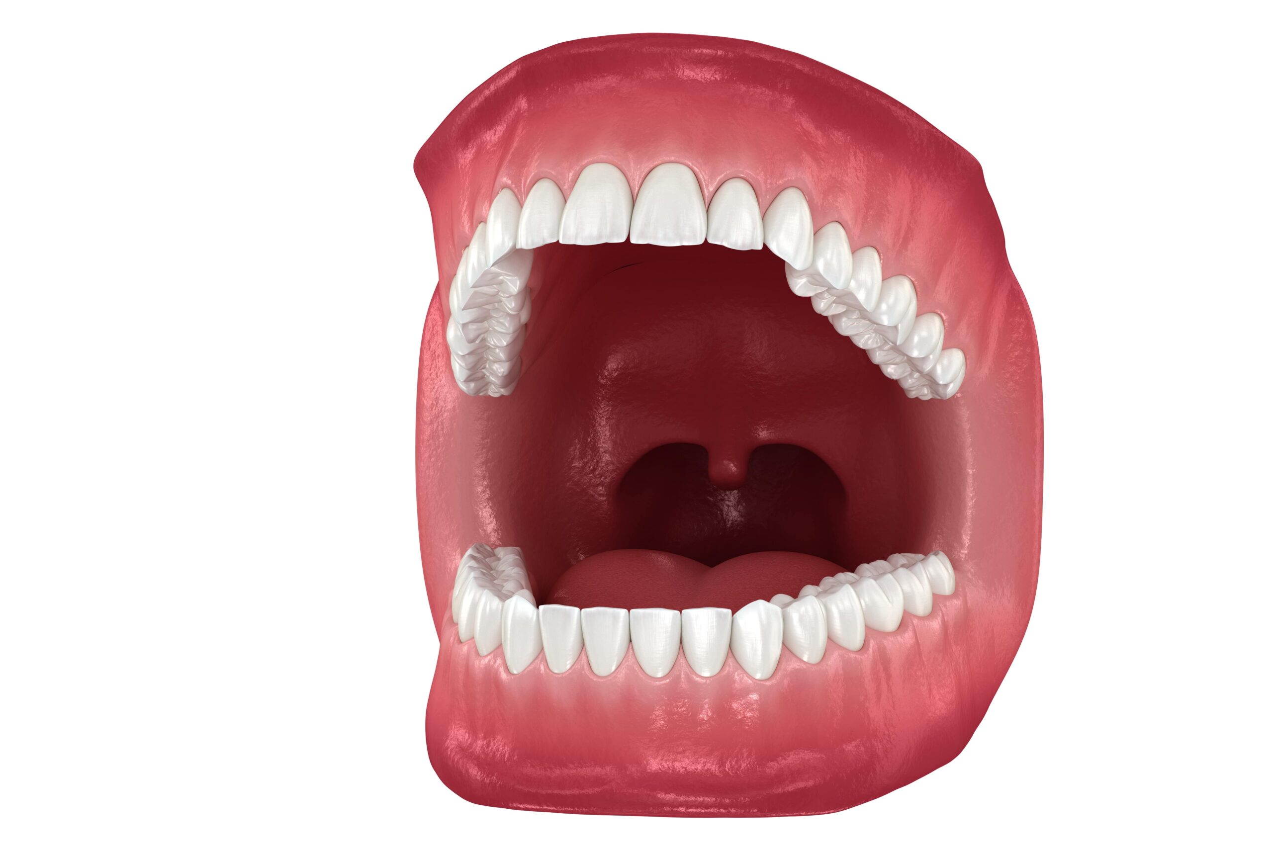 3D illustration of an open mouth showing teeth and soft tissue for Nightlase snoring treatment