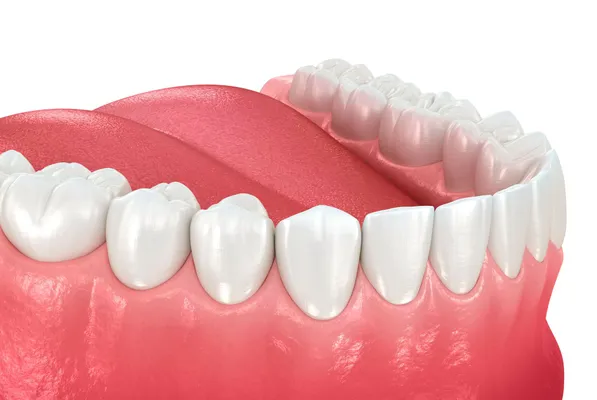 Illustrated view of teeth and gums for oral cancer screening