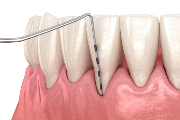 Illustrated diagram showing periodontal care and gum treatment