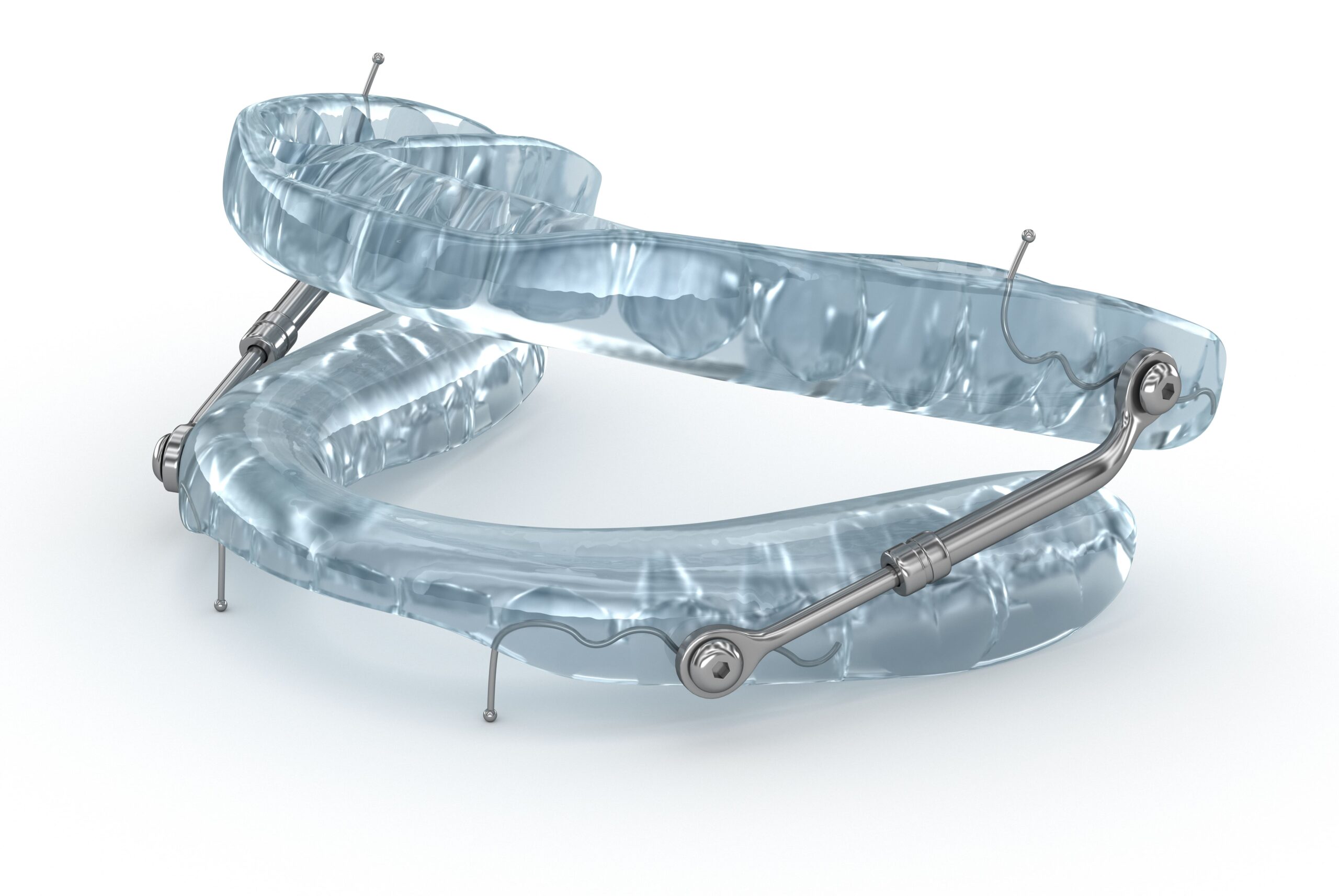 3D illustration of a mandibular advancement device used for sleep apnea treatment