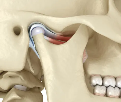 Illustrated diagram of the temporomandibular joint for TMJ treatment