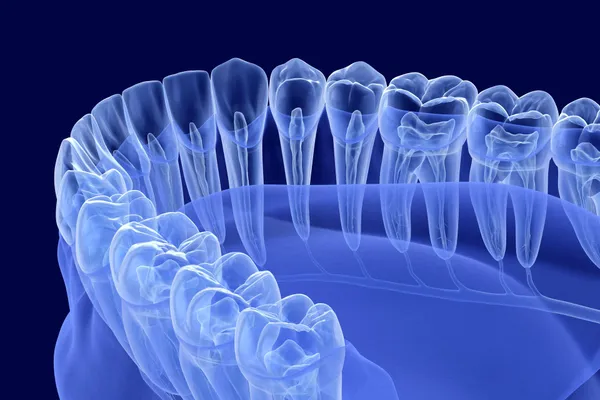 Illustrated dental X ray view showing tooth and root structure