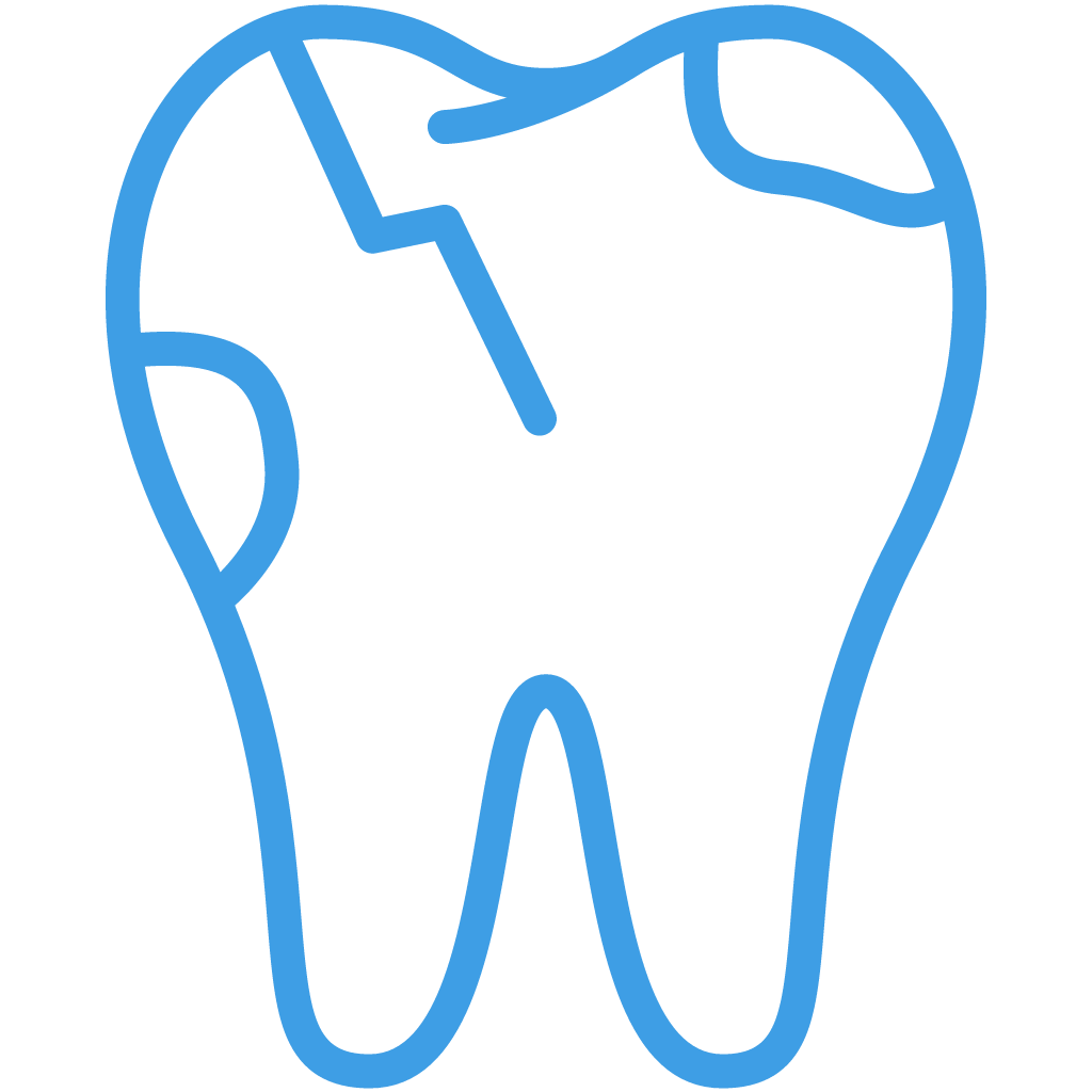 Tooth with a crack running through it, illustrating dental damage.