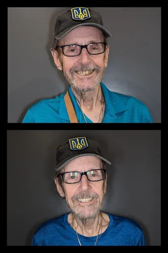 Before and after dental treatment results for a patient at Joshua M. Ignatowicz DMD & Associates