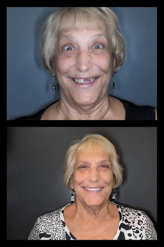Before and after dental treatment results for a patient at Joshua M. Ignatowicz DMD & Associates