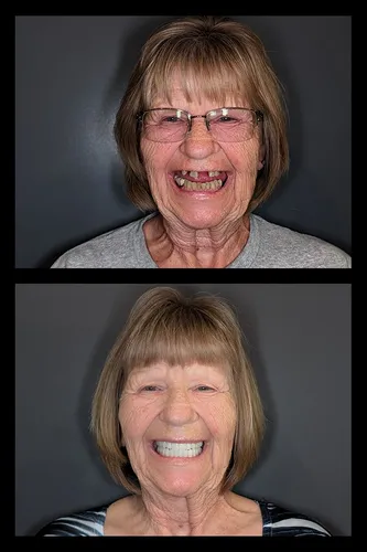 Before and after dental treatment results for a patient at Joshua M. Ignatowicz DMD & Associates
