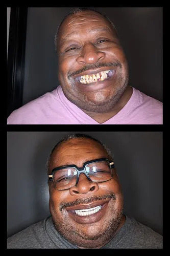Before and after dental treatment results for a patient at Joshua M. Ignatowicz DMD & Associates