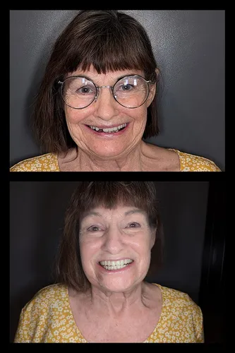 Before and after dental treatment results for a patient at Joshua M. Ignatowicz DMD & Associates