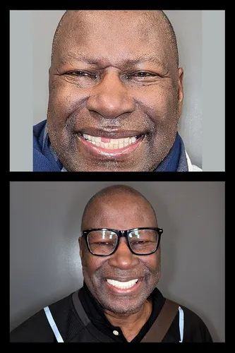 Before and after dental treatment results for a patient at Joshua M. Ignatowicz DMD & Associates