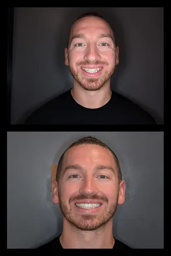 Before and after dental treatment results for a patient at Joshua M. Ignatowicz DMD & Associates
